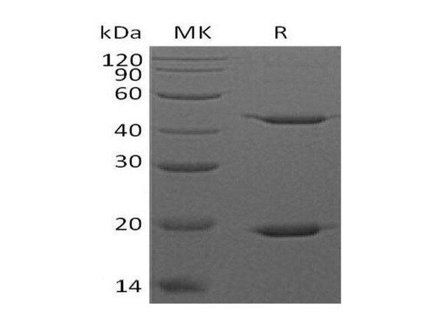 Human STAT3 Recombinant Protein (RPES5009)
