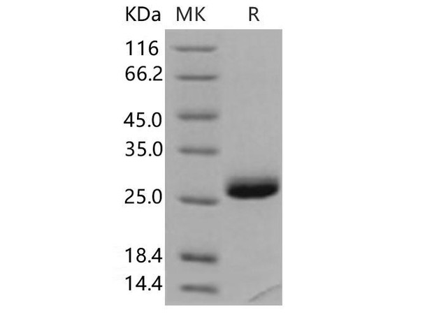 Human TIMP/TIMP1 Recombinant Protein  (RPES5019)