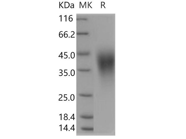 Human B7-H5/Gi24/VSIR Recombinant Protein (RPES5038)