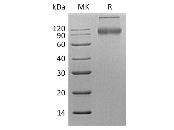 Human CD200R1 Recombinant Protein (RPES5045)