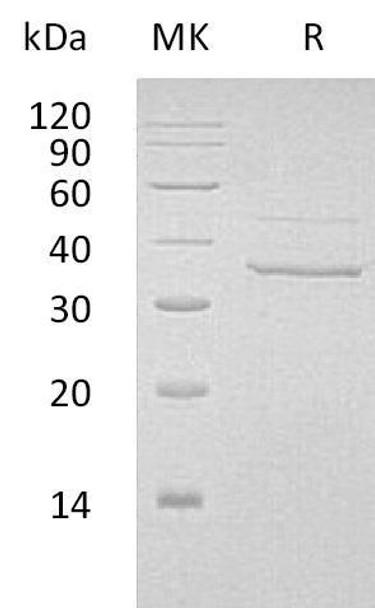 Human Myozenin-2/MYOZ2 Recombinant Protein (RPES5047)