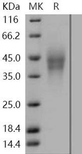Human LMIR2/CD300C Recombinant Protein (RPES5058)