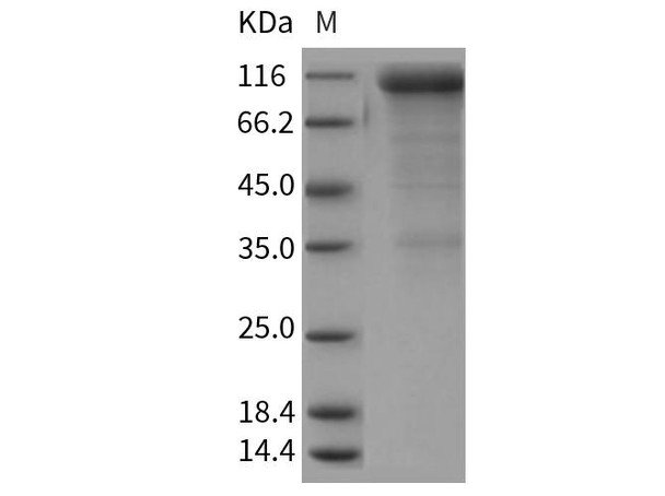 Rat CD36/SCARB3 Recombinant Protein (RPES5061)