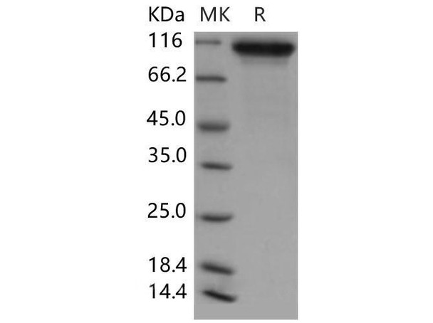 Mouse Neuroligin 1/NLGN1 Recombinant Protein (RPES5062)