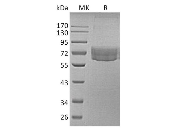 Human TIM-3/HAVCR2 Recombinant Protein (RPES5095)