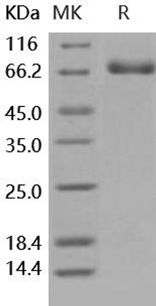 Human EphB4/HTK Recombinant Protein (RPES5118)