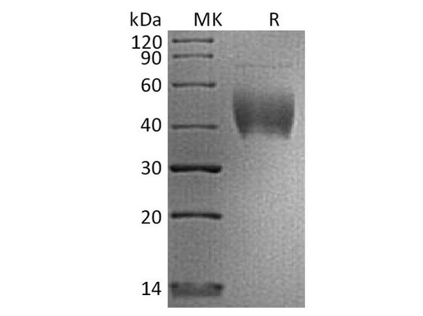 Human PD-L2/CD273 Recombinant Protein (RPES5153)