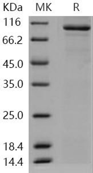 Human STXBP3/UNC8C Recombinant Protein (RPES5155)