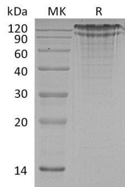 Human LDLR Recombinant Protein (RPES5157)