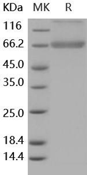 Human Decorin/DCN Recombinant Protein (RPES5162)
