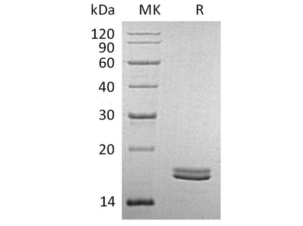 Human CD40L/TNFSF5 Recombinant Protein (RPES5163)