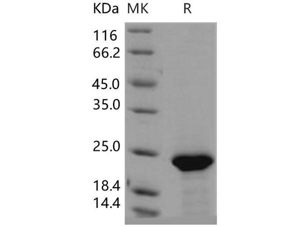 Human FGF21 Recombinant Protein (RPES5196)