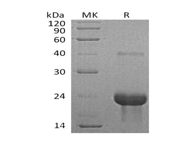Mouse TNFR1/TNFRSF1A Recombinant Protein (RPES5210)