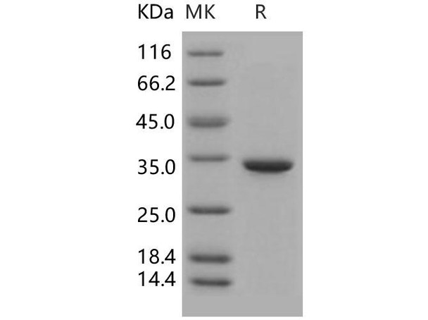 Carbonic Anhydrase 5B/CA5B Recombinant Protein (RPES5221)