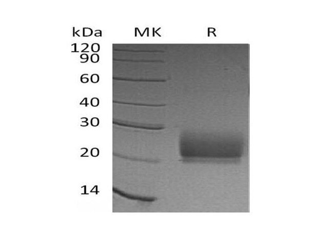 Human KLRD1/CD94 Recombinant Protein (RPES5225)