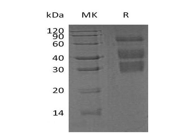 Mouse Clusterin/ApoJ Recombinant Protein (RPES5231)