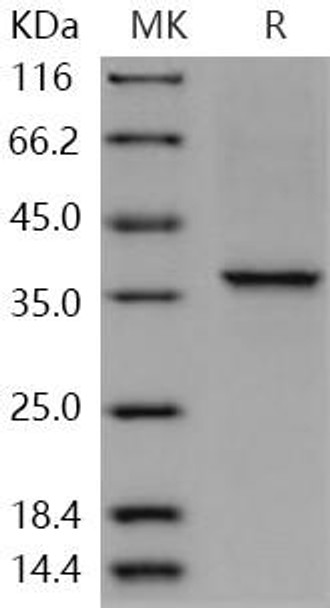 Human COL2A1 Recombinant Protein (RPES5237)