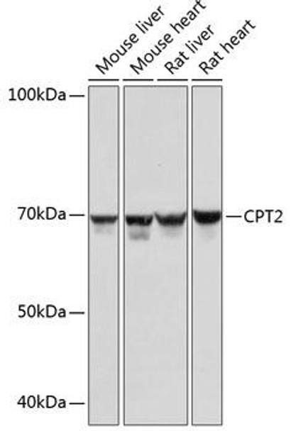 Metabolism Antibodies 3 Anti-CPT2 Antibody CAB0653