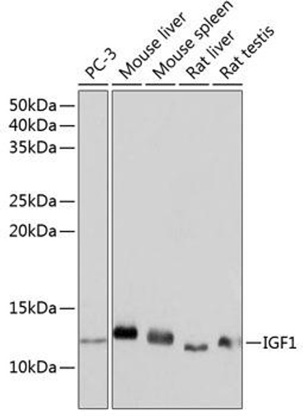 Cell Biology Antibodies 16 Anti-IGF1 Antibody CAB0830