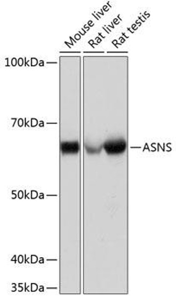 Metabolism Antibodies 3 Anti-ASNS Antibody CAB1030