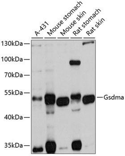 Cell Biology Antibodies 16 Anti-Gsdma Antibody CAB10602