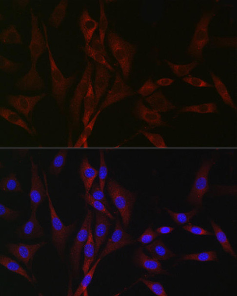 Immunofluorescence analysis of NIH/3T3 cells using CACNA1H Rabbit pAb at dilution of 1:100 (40x lens). Blue: DAPI for nuclear staining.