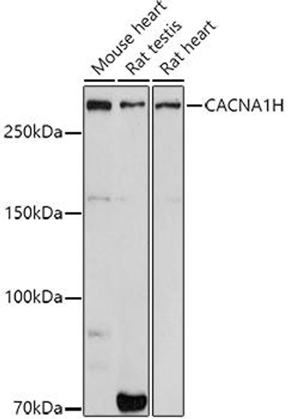 Western blot analysis of extracts of various cell lines, using CACNA1H antibody at 1:1000 dilution. Secondary antibody: HRP Goat Anti-Rabbit IgG (H+L) at 1:10000 dilution. Lysates/proteins: 25ug per lane. Blocking buffer: 3% nonfat dry milk in TBST. Detection: ECL Basic Kit. Exposure time: 180s.