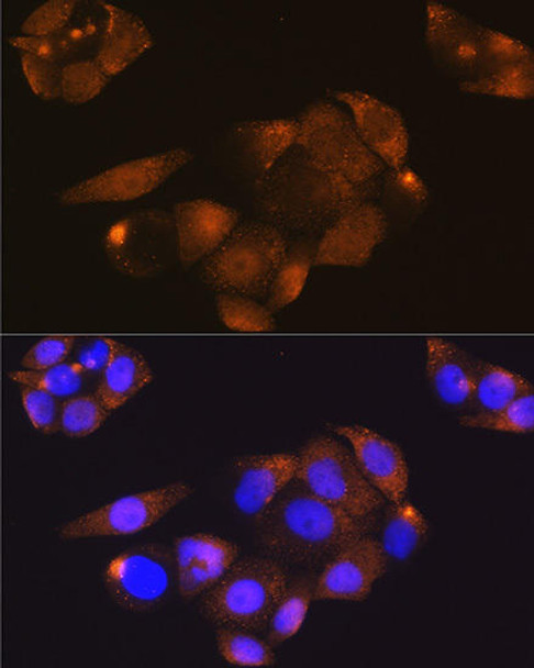 KO Validated Antibodies 1 Anti-CDK4KO Validated Antibody CAB11136