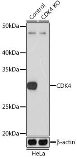 KO Validated Antibodies 1 Anti-CDK4KO Validated Antibody CAB11136