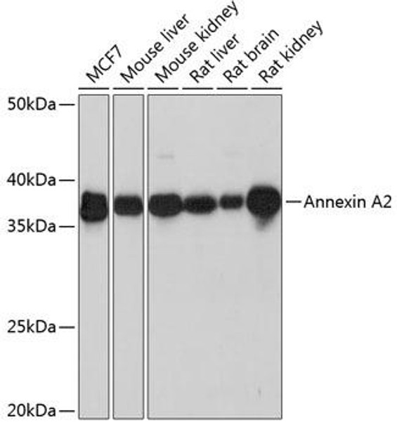 Immunology Antibodies 3 Anti-Annexin A2 Antibody CAB11235