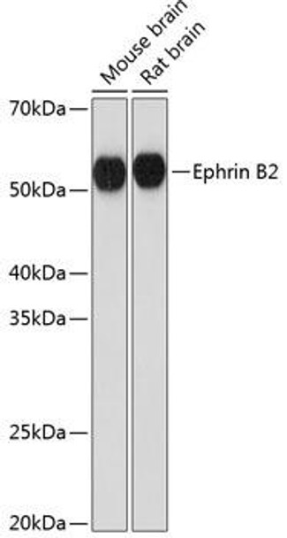 Cardiovascular Antibodies Anti-Ephrin B2 Antibody CAB11349