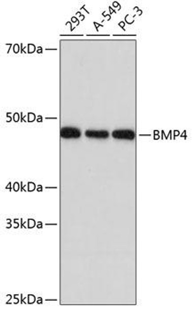 Cell Biology Antibodies 16 Anti-BMP4 Antibody CAB11405