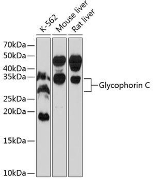 Cell Biology Antibodies 16 Anti-Glycophorin C Antibody CAB11472