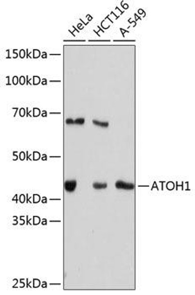 Developmental Biology Anti-ATOH1 Antibody CAB11477