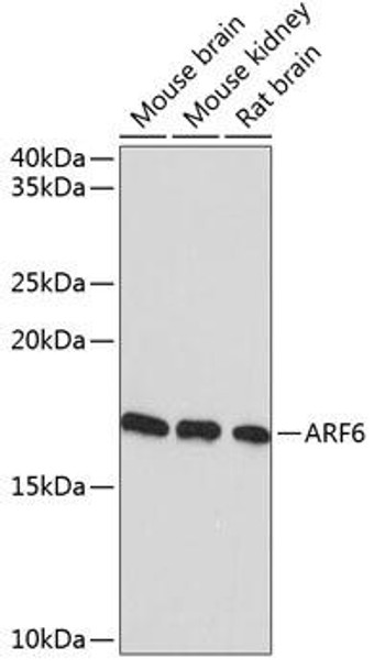 Cell Cycle Antibodies 2 Anti-ARF6 Antibody CAB11485