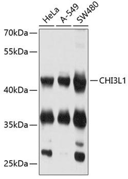 Cell Death Antibodies 2 Anti-CHI3L1 Antibody CAB11510