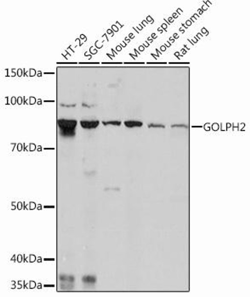 Cell Biology Antibodies 16 Anti-GOLPH2 Antibody CAB11538