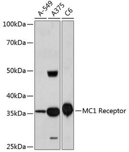 KO Validated Antibodies 1 Anti-MC1 ReceptorKO Validated Antibody CAB11594