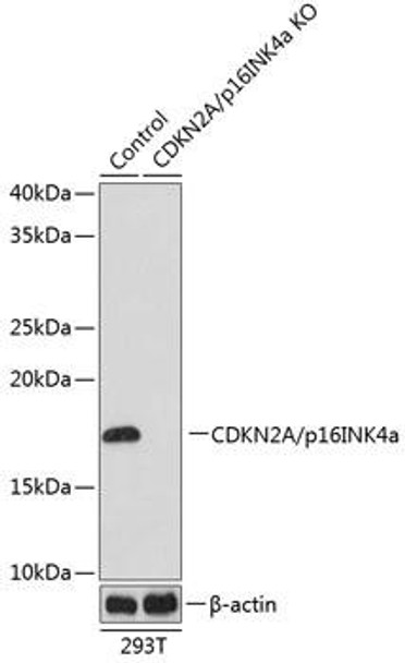 KO Validated Antibodies 1 Anti-CDKN2A/p16INK4aKO Validated Antibody CAB11651