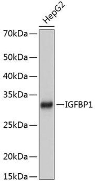 Cell Biology Antibodies 16 Anti-IGFBP1 Antibody CAB11672