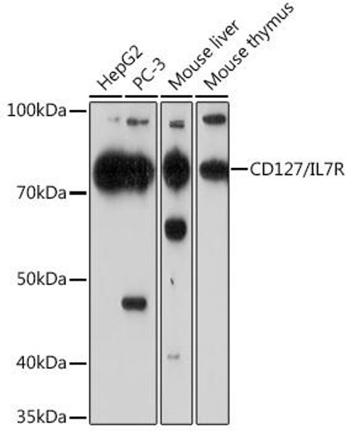 Cell Biology Antibodies 16 Anti-CD127/IL-7R Antibody CAB11678