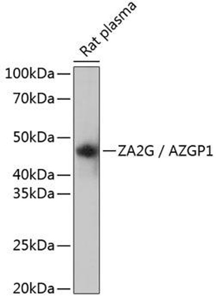 Cell Biology Antibodies 16 Anti-ZA2G / AZGP1 Antibody CAB11680