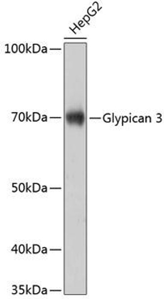 Cell Biology Antibodies 16 Anti-Glypican 3 Antibody CAB11686
