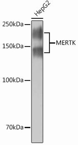 Cell Biology Antibodies 13 Anti-MERTK Antibody CAB12294