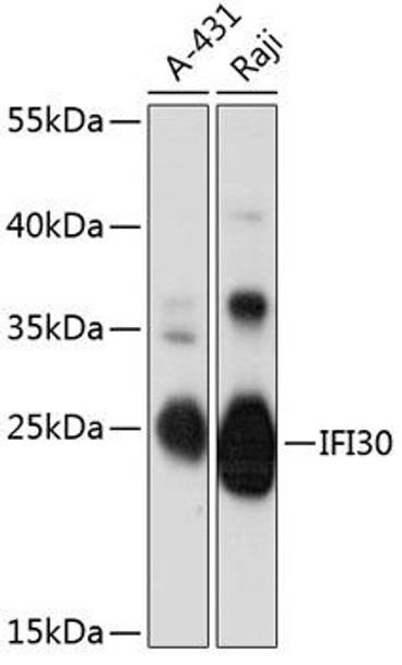 Cell Biology Antibodies 14 Anti-IFI30 Antibody CAB12995