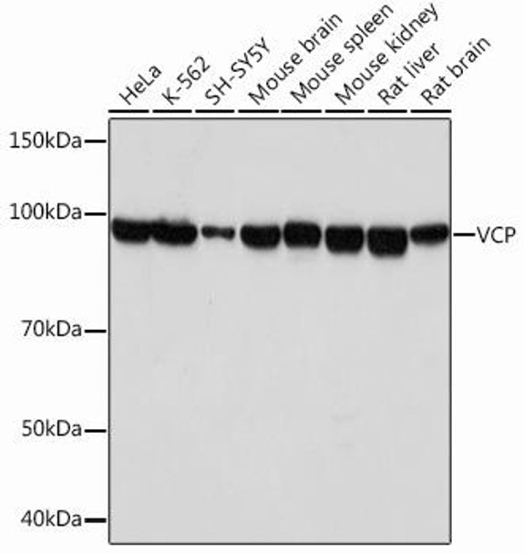 Autophagy Antibodies Anti-VCP Antibody CAB1402