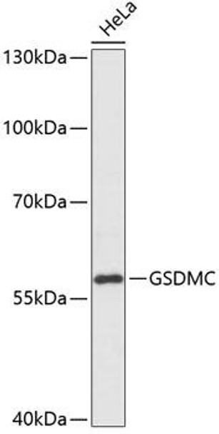 Cell Biology Antibodies 14 Anti-GSDMC Antibody CAB14550