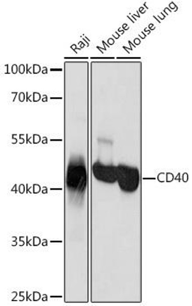 Immunology Antibodies 3 Anti-CD40 Antibody CAB13285