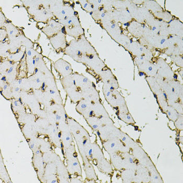 KO Validated Antibodies 1 Anti-ANXA2 Antibody CAB1572KO Validated