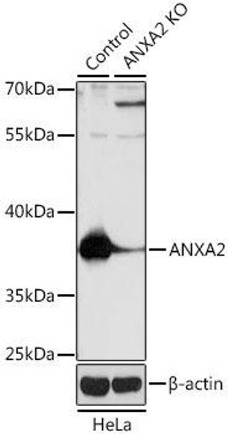 KO Validated Antibodies 1 Anti-ANXA2 Antibody CAB1572KO Validated